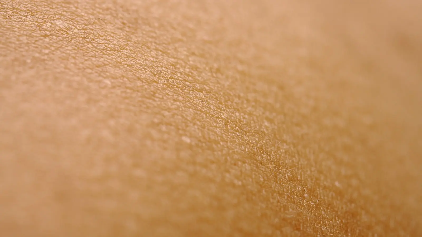 Psoriasis Treatment in Australia: What Helps