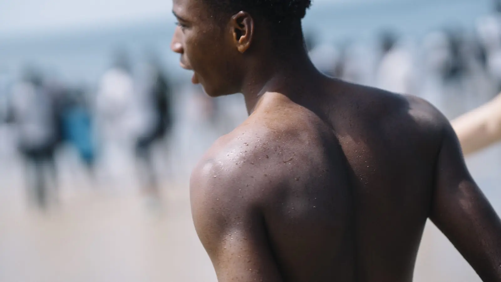 Sunburn Treatment in Australia: Relief & Care